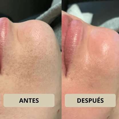 Rose Astor - Peel Shot Coreano