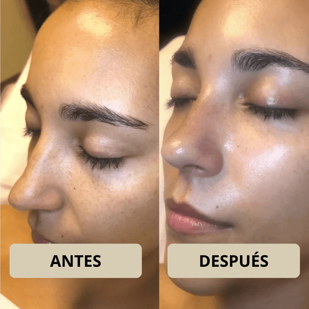 Rose Astor - Peel Shot Coreano