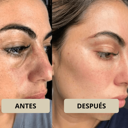 Rose Astor - Peel Shot Coreano