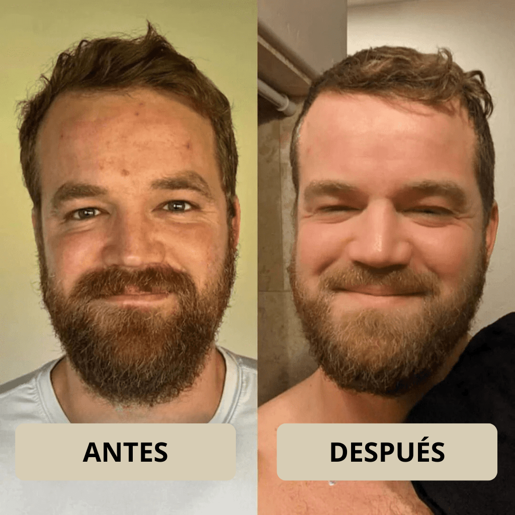 Rose Astor - Peel Shot Coreano